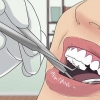 Eine dicke lippe behandeln