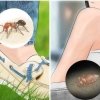 Insektenstiche erkennen
